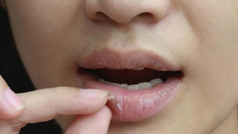 Winter lips not cracked enough to tease!